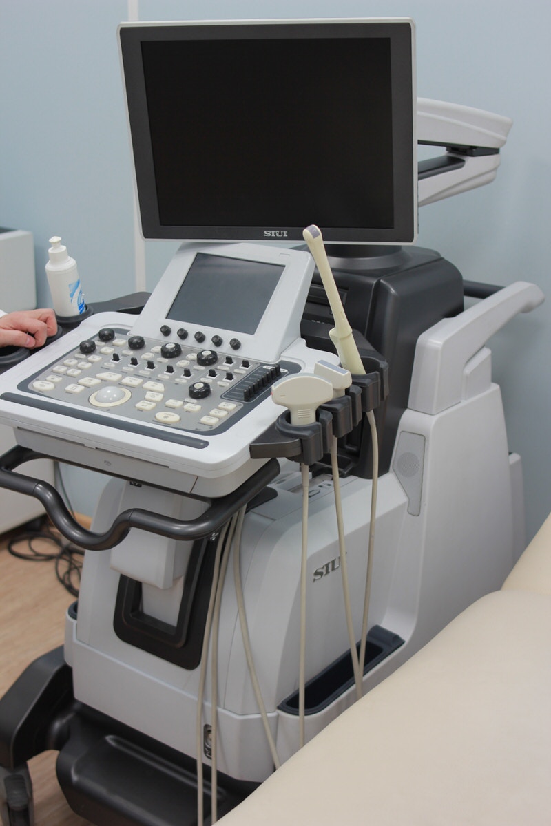 Ultrasound Wanda Internal IVF In Vitro Fertilization Fertility Treatment Infertility Miscarriage Blog Support Resources