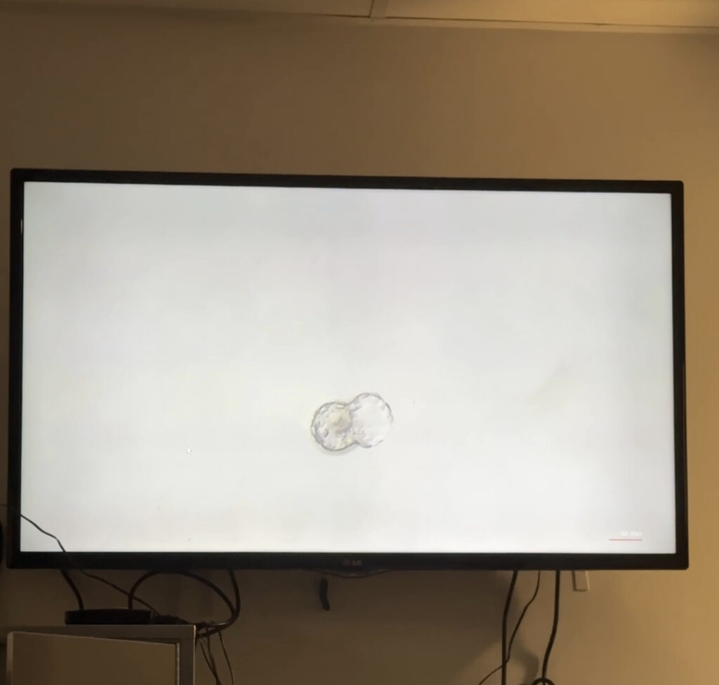 Embryo Hatching IVF Blog Experiences Journey